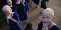 В Танзании очередной ребенок-альбинос принесен в жертву в ходе магического ритуала