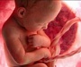 Новосибирские врачи впервые прооперировали ребенка в утробе матери