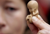 В Церкви предлагают лишать лицензии врачей, предлагающих аборты
