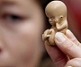 В Церкви предлагают лишать лицензии врачей, предлагающих аборты
