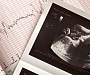 Техас стал первым штатом, где введен запрет на аборты после обнаружения сердцебиения плода